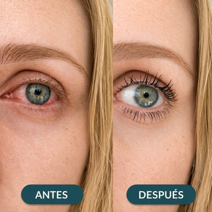Vaporizador para ojos secos y cansados